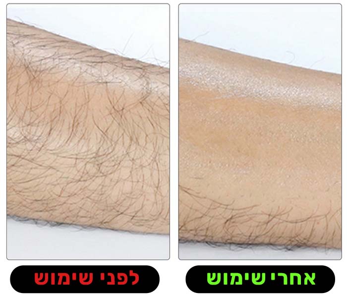 מגלח הקסם